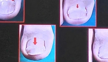 Consultorio Pies Libres - 15600 Pando Consultorio Pies Libres - 15600 Pando