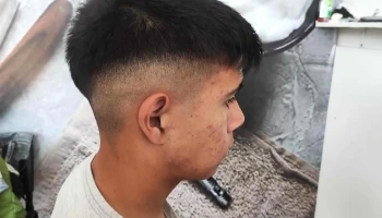 La Maquina Barber - Dr. Jose Verocay Y