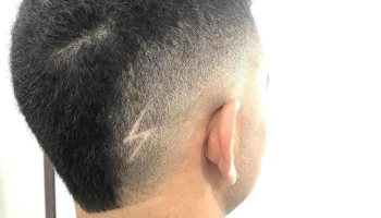 S.L_Barber's - Dr. Antonio Legnani S.L_Barber's - Dr. Antonio Legnani