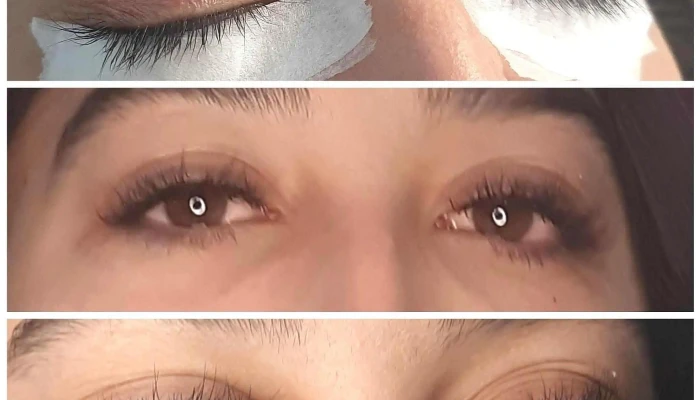 Centro Estético Teresa Mariño - 14000 Canelones