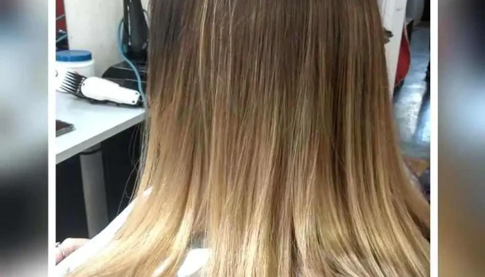 Centro Estetico Venus - 11600 Montevideo