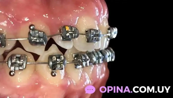 Clinica Dental Dra Mikaella Rodriguez Olivera Videos - Maldonado