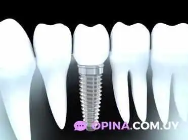 Consultorio Odontologico Dr Jack Cizin Diente - Montevideo