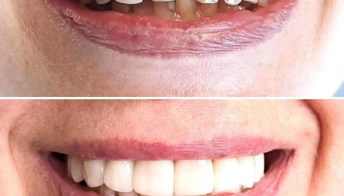Dental Restyling -  Ubicacion - Montevideo