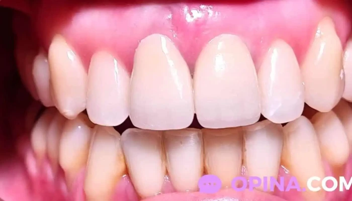 Dentalmas22 -  Del Propietario - Montevideo