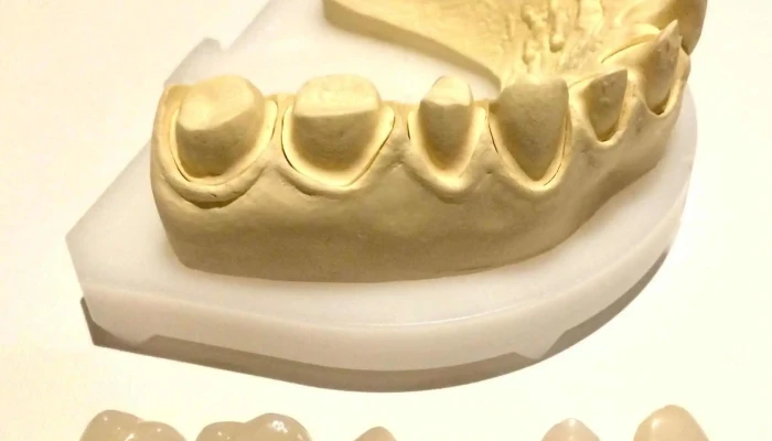 Dr Sebastian Renom Drmarcelo Lopez Clinica Lopezrenom Odontologos Diente - Pando