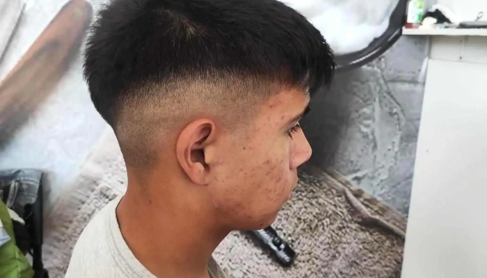 La Maquina Barber - Dr. Jose Verocay Y