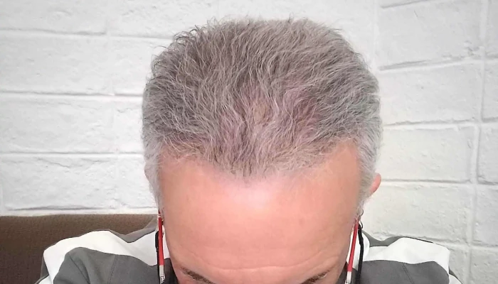 Medical Hair Montevideo - Montevideo